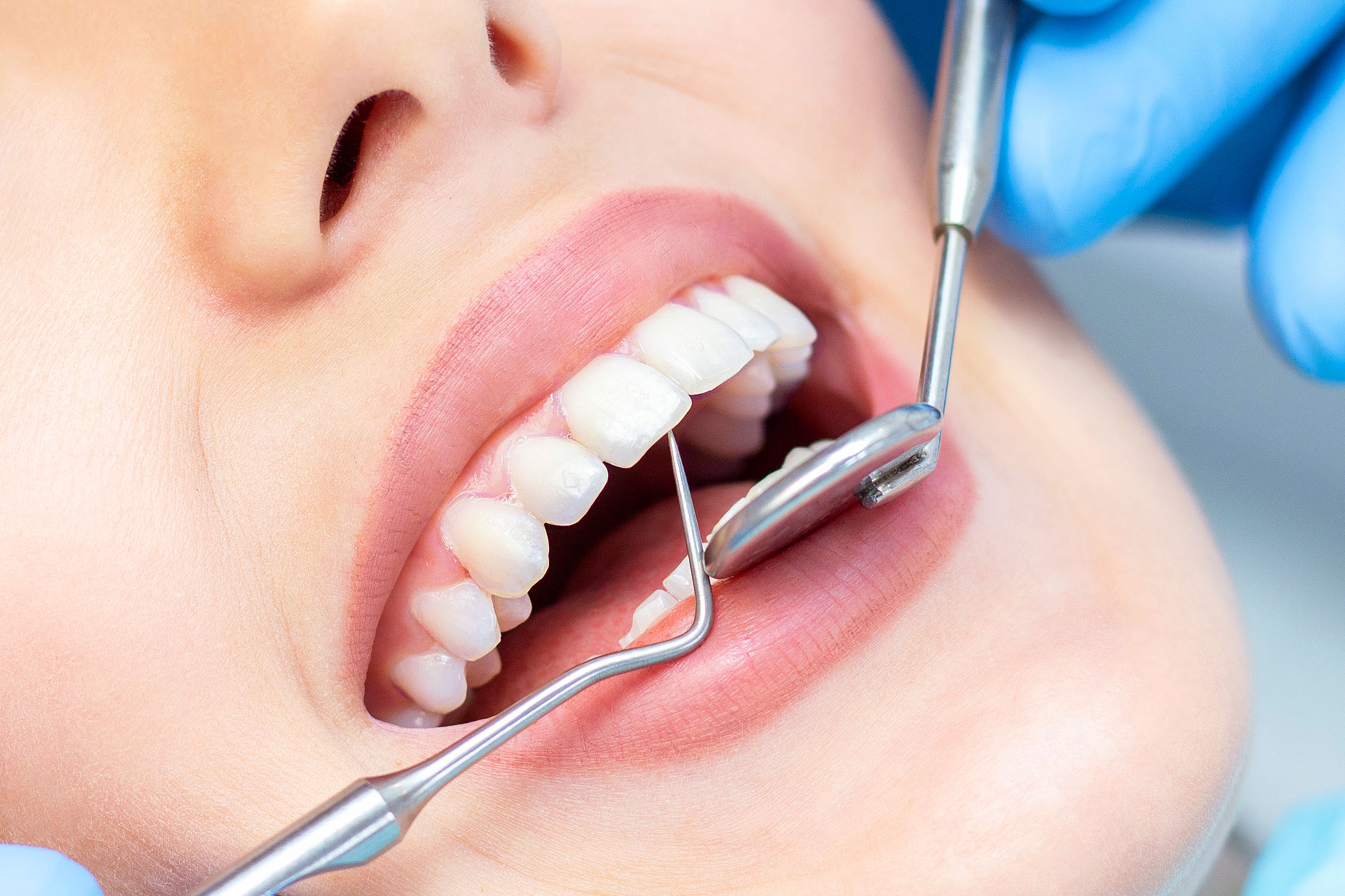 https://www.dentalesthetic-implant.com/wp-content/uploads/2022/08/hasta-gorusleri.jpg